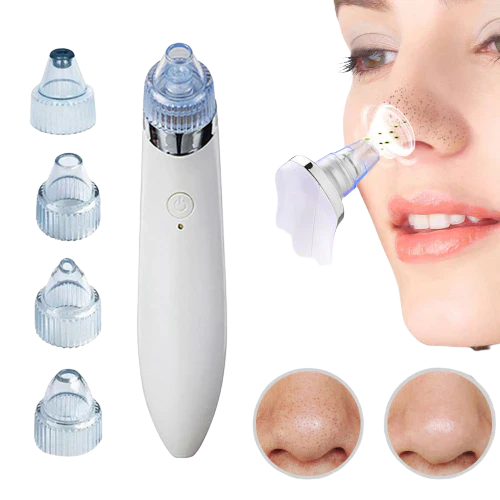 4-In-1 Blackhead Remover Derma Suction Pore Vacuum Tool