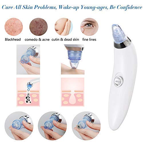 4-In-1 Blackhead Remover Derma Suction Pore Vacuum Tool