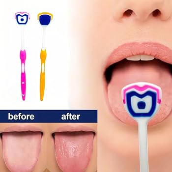 Stainless Steel Tongue Scraper — Oral Hygiene Cleaner